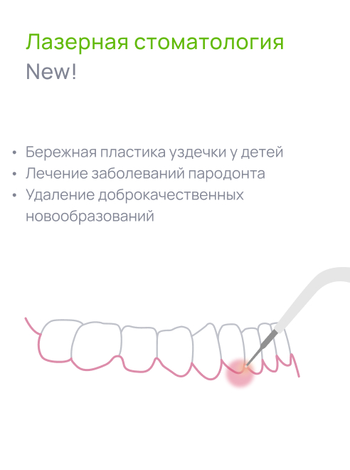 Лазерная стоматология 